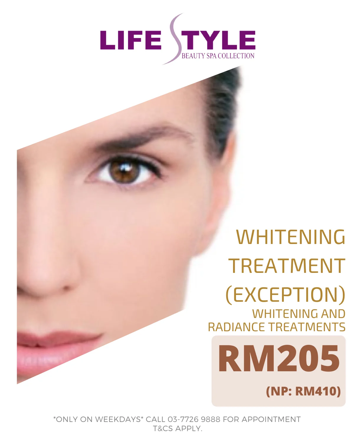 WHITENING AND RADIANCE TREAMENTS - WHITENING TREATMENT (EXCEPTION) VOUCHER